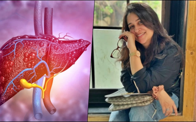 दीपिका कक्कड़ को हुआ लिवर कैंसर: जानिए इस बीमारी के लक्षण, कारण और इलाज के विकल्प